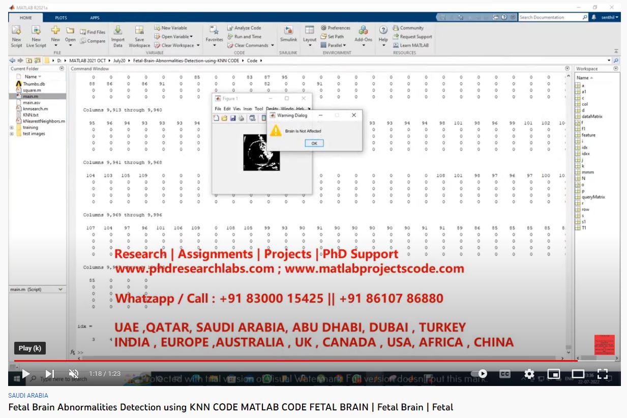 Fetal-Brain-Abnormalities-Detection-using-KNN CODE -MATLAB CODE- FETAL BRAIN project thumbnail image