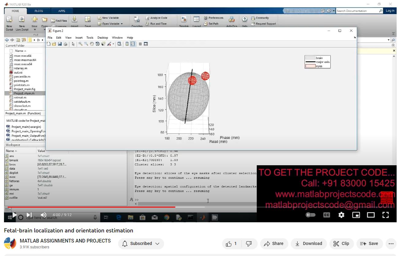 Fetal-Brain Localization And Orientation Estimation project thumbnail image