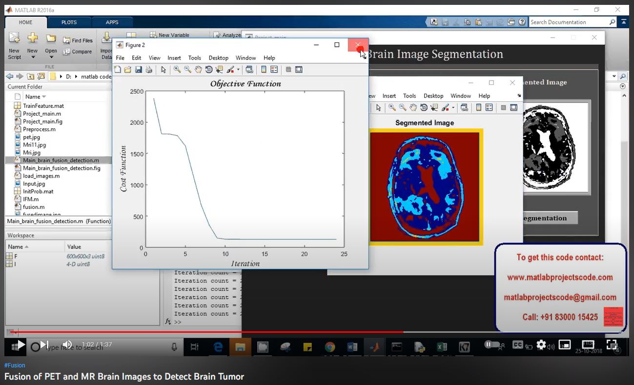 Fusion of PET and MR Brain Images to Detect Brain Tumor project thumbnail image