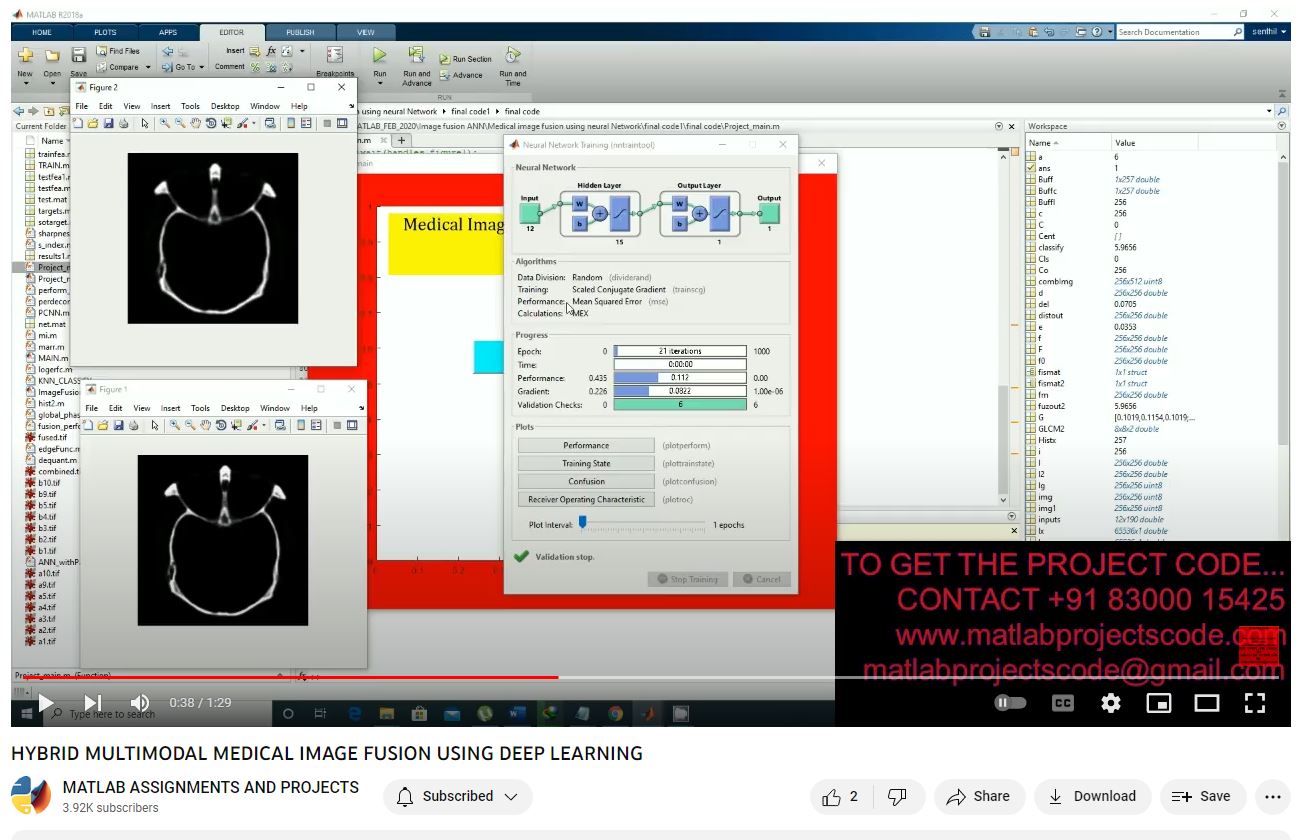 Hybrid Multimodal Medical Image Fusion Using Deep Learning project thumbnail image