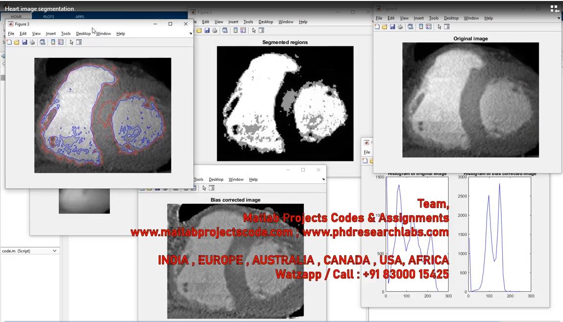 Heart Image Segmentation project thumbnail image