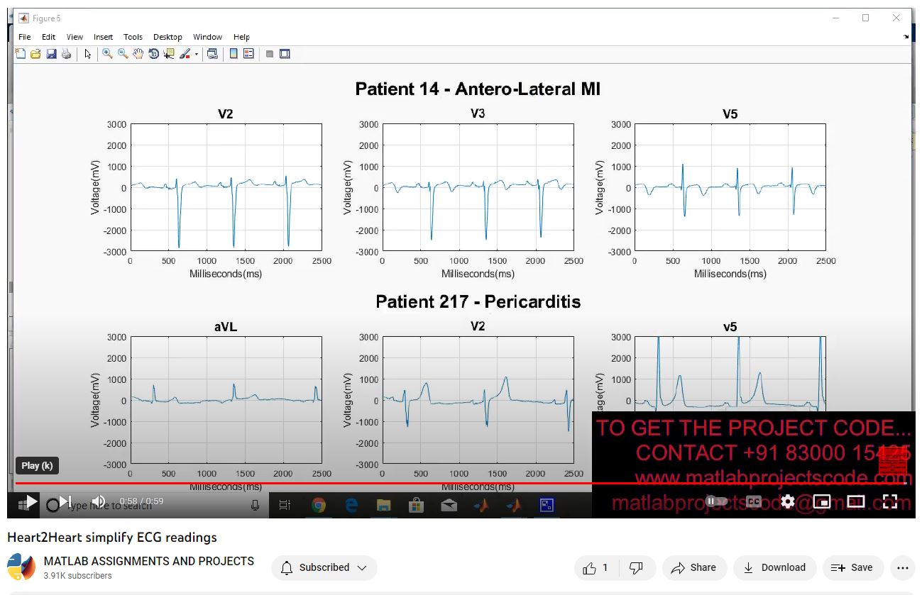 Heart2Heart Simplify Ecg Readings project thumbnail image