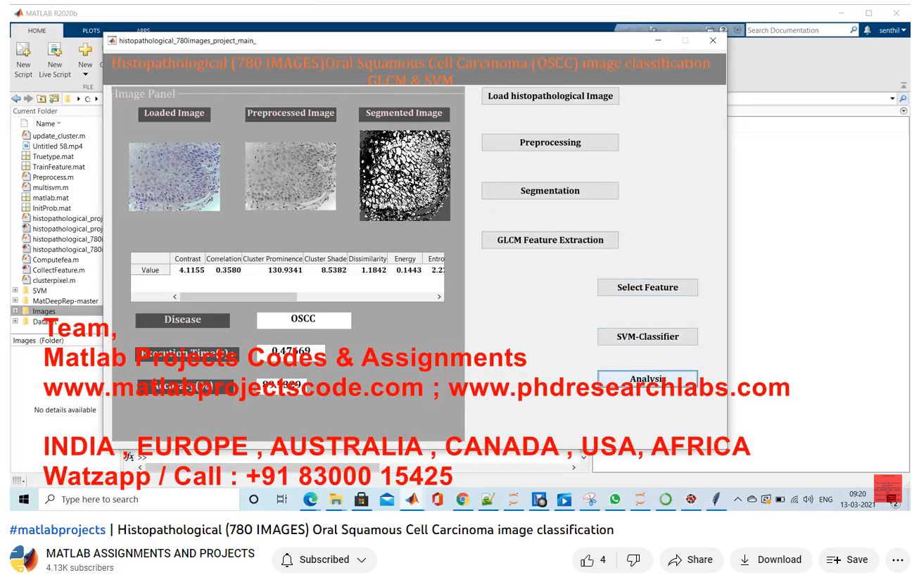 Histopathological 780 Images Oral Squamous Cell Carcinoma Image Classification project simulation thumbnail for Signal Processing and AI Engineering