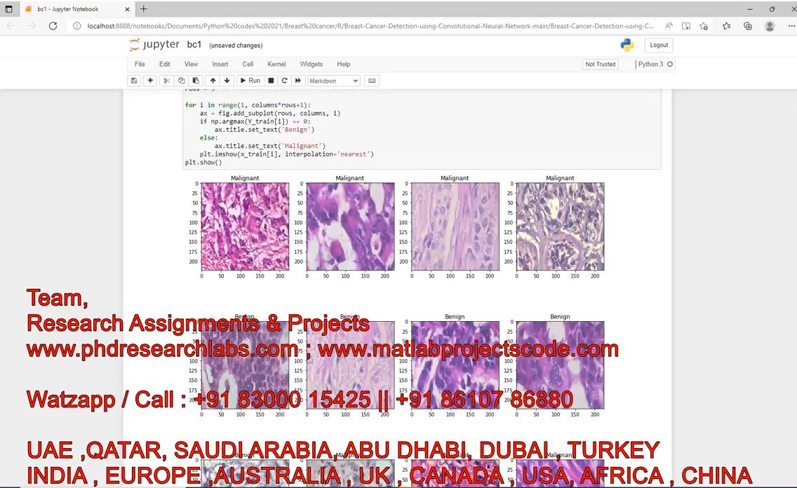 Histopathological Images For Prediction Of Breast Cancer Using Python Code _ Breast Cancer project thumbnail image