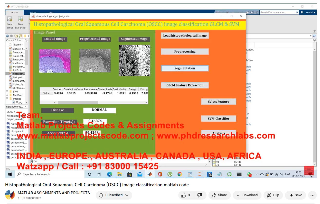 Histopathological Oral Squamous Cell Carcinoma Oscc Image Classification Matlab Code project simulation thumbnail for Signal Processing and AI Engineering