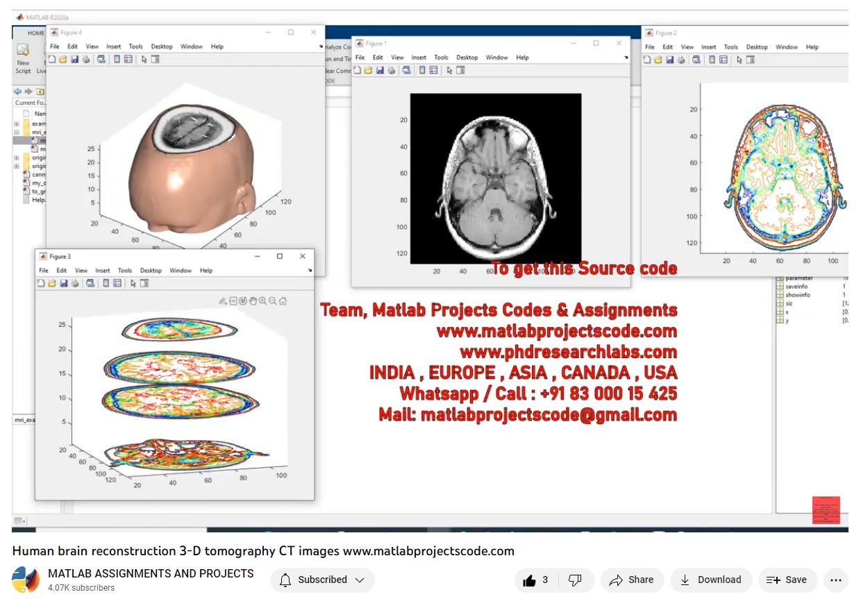Human Brain Reconstruction 3-D Tomography Ct Images-Matlab Simulink-Electrical Assignments-Projects-Phd Research project thumbnail image