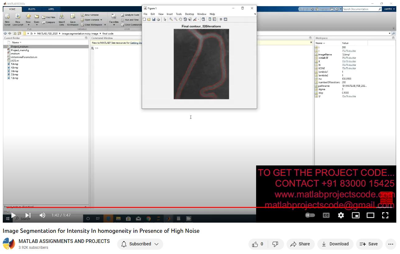 Image Segmentation For Intensity In Homogeneity In Presence Of High Noise project thumbnail image