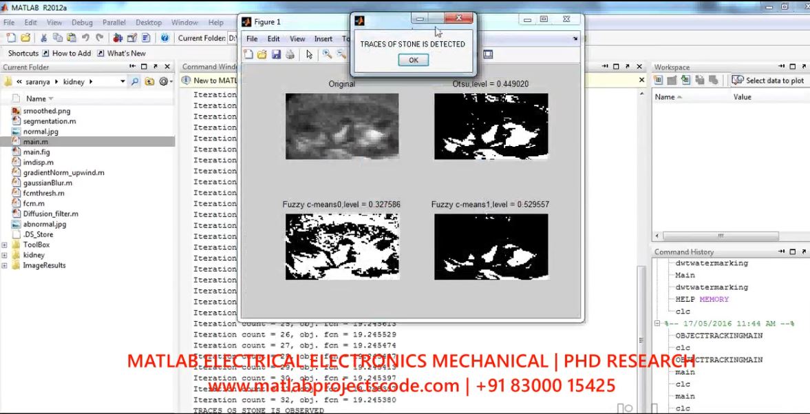 Irregularity Detection In Kidney Stone Ultrasound Imaging project thumbnail image