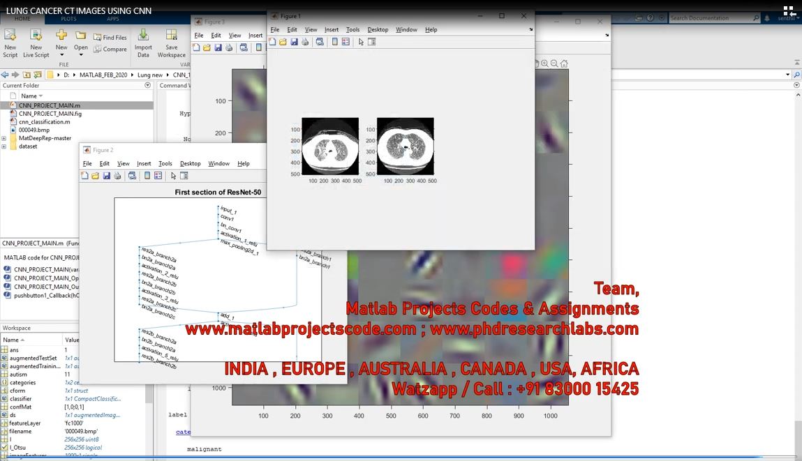 Lung Cancer Ct Images Using Cnn project thumbnail image