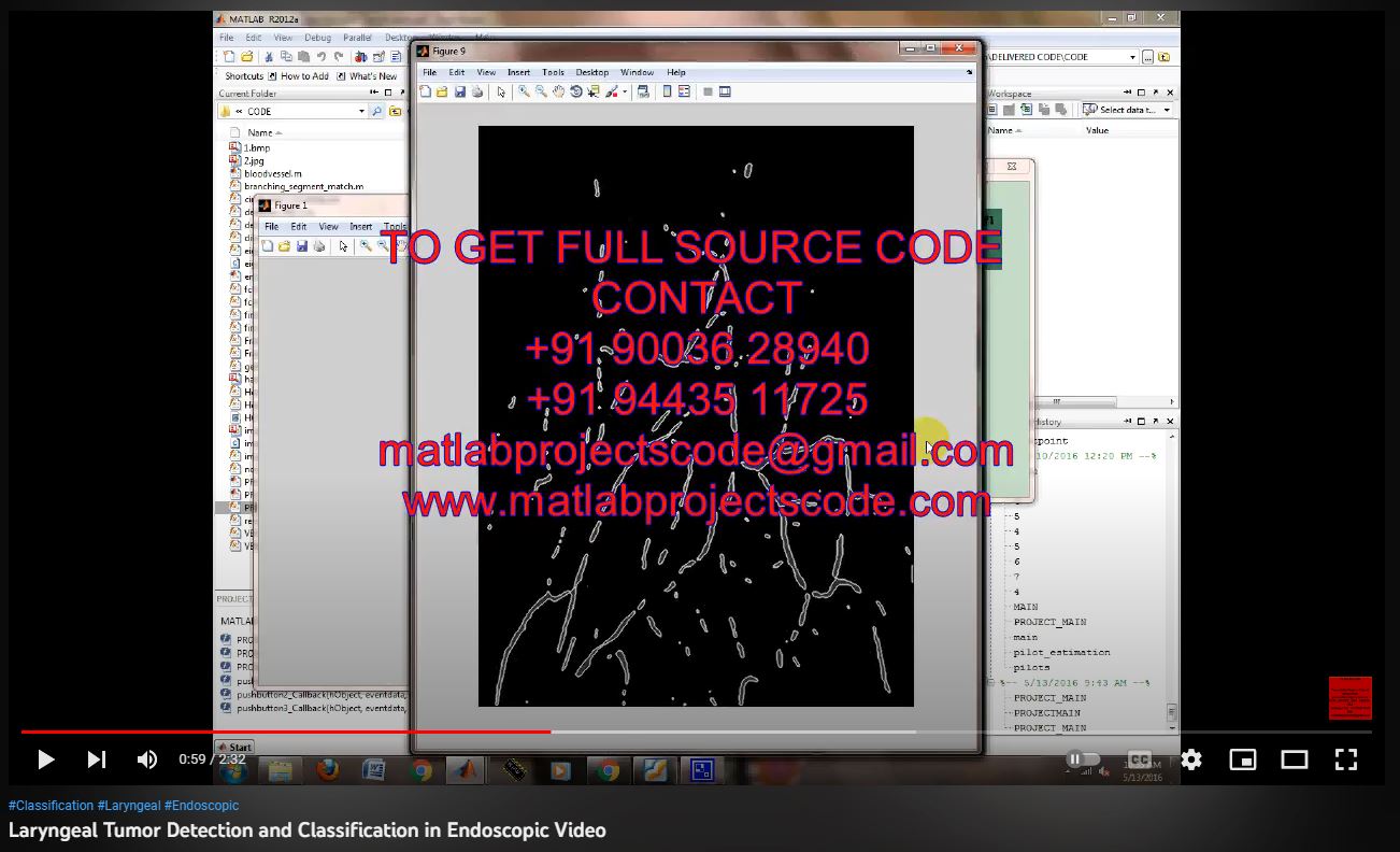 Laryngeal Tumor Detection and Classification in Endoscopic Video-MATLAB project thumbnail image