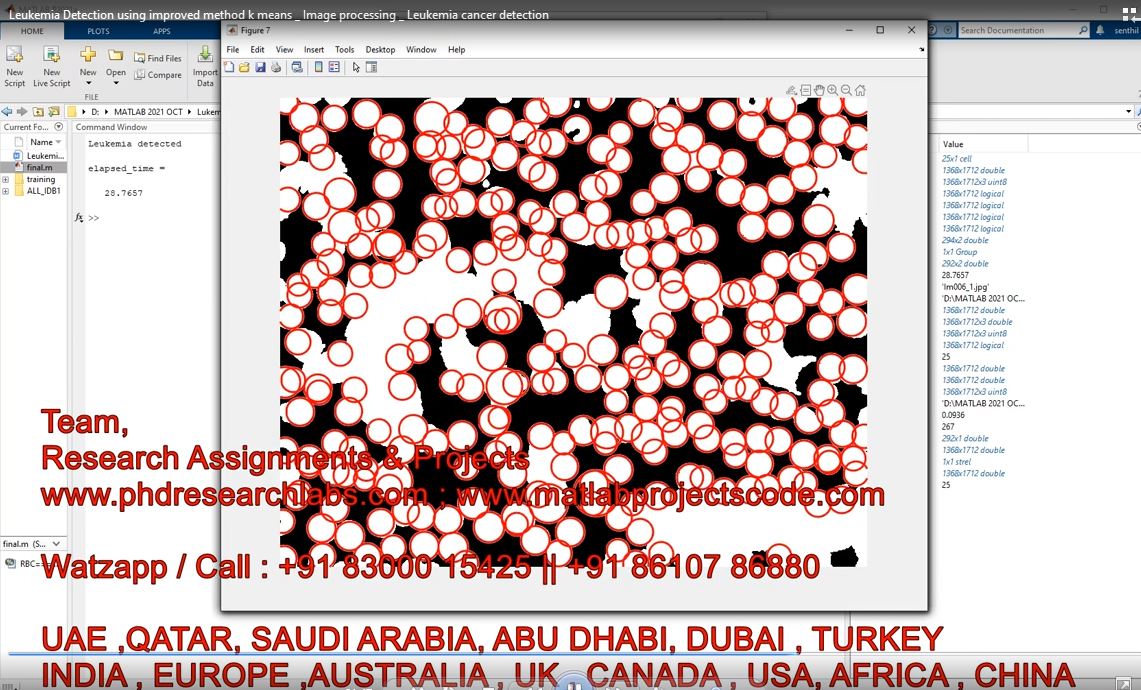 Leukemia Detection Using Improved Method K Means _ Image Processing _ Leukemia Cancer Detection project thumbnail image