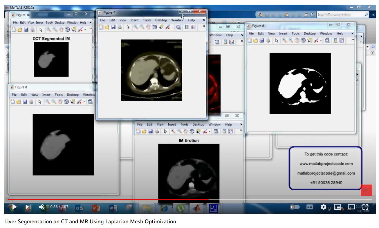 Liver Segmentation on CT and MR using Laplacian Mesh Optimization project thumbnail image