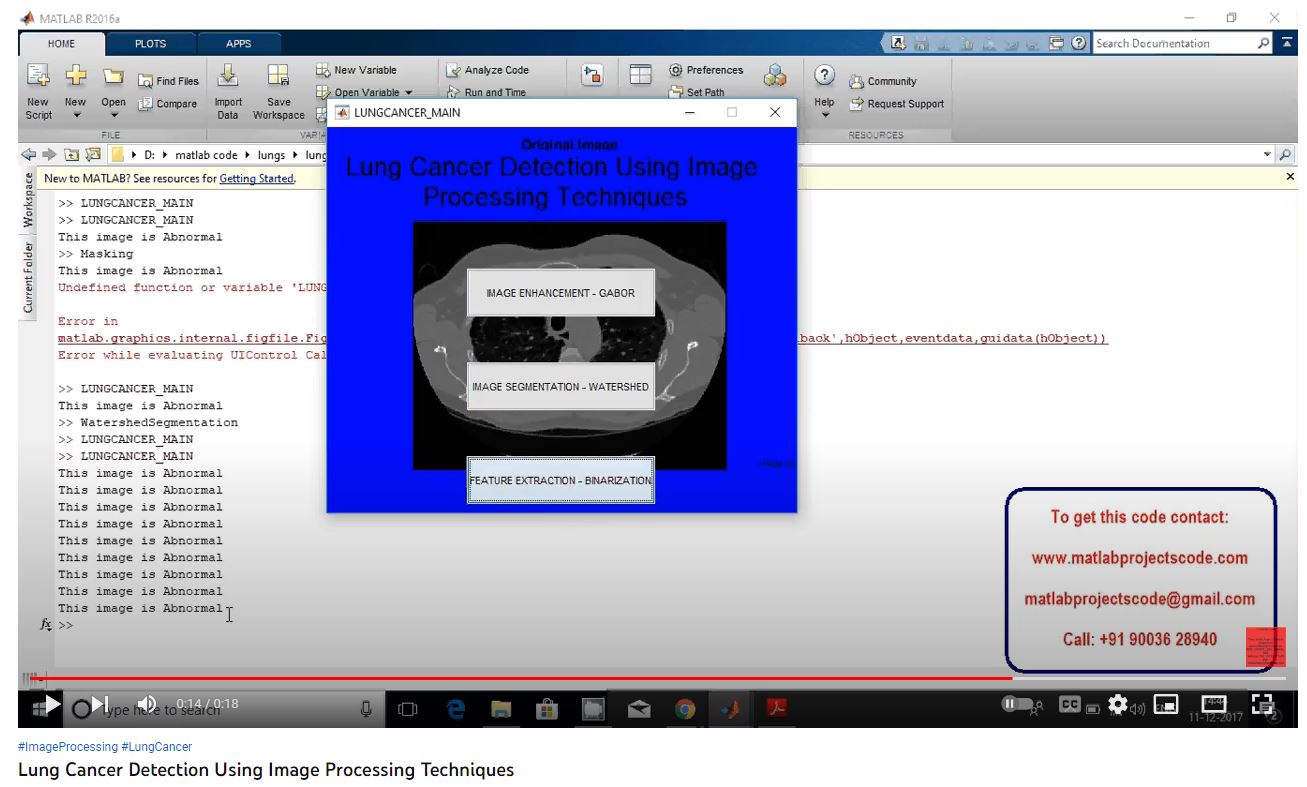 Lung Cancer Detection using Image Processing Techniques project thumbnail image