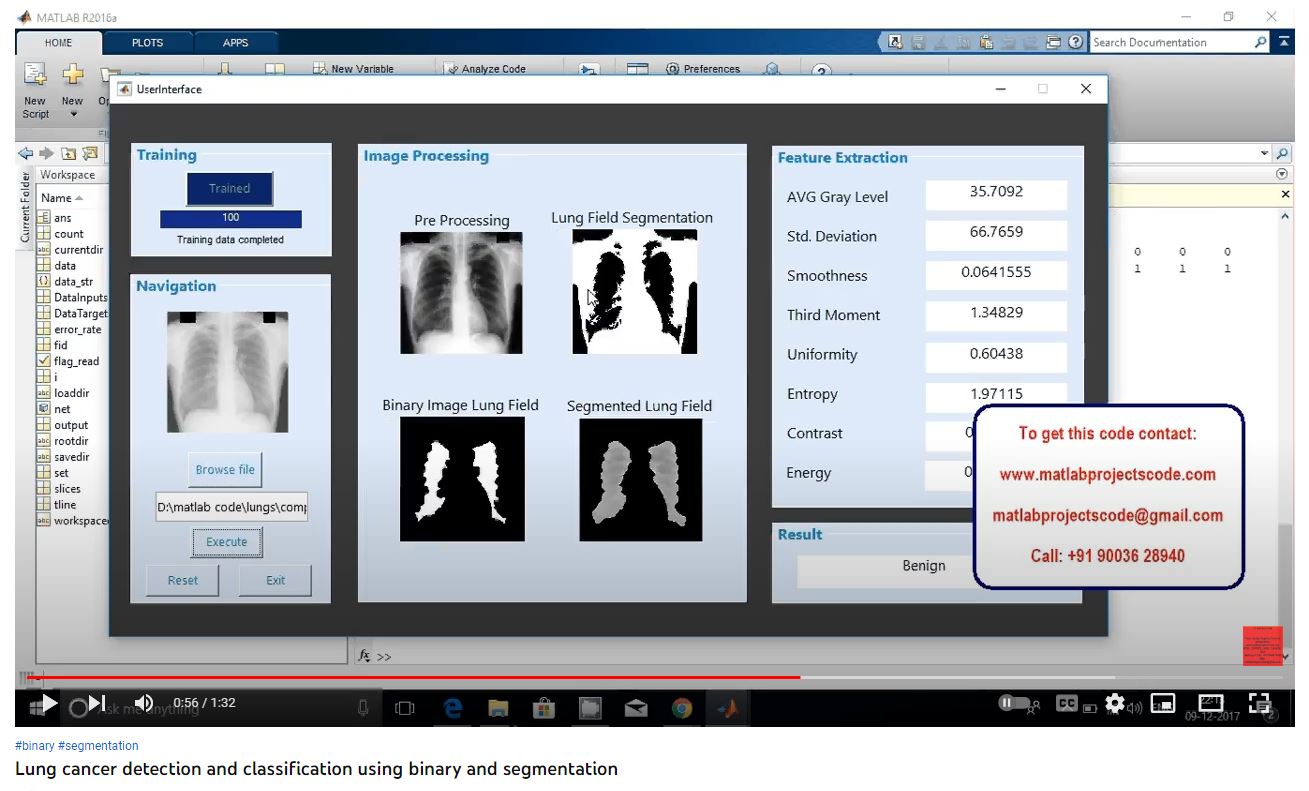 Lung Cancer Detection and Classification using Binary and Segmentation project thumbnail image