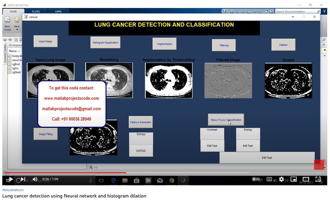Lung Cancer Detection using Neural Network and Histogram Dilation project thumbnail image