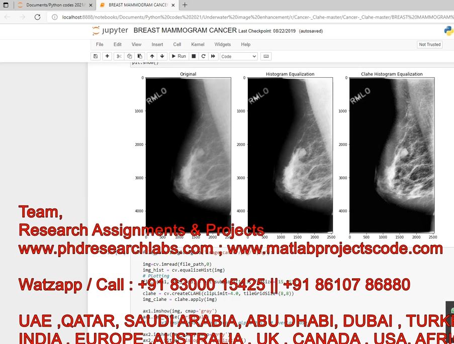 Mammogram Cancer Using Clahe _ Python Code _ Breast Cancer _ Mammogram _ Clahe _ Python Project project thumbnail image