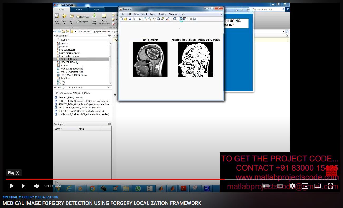 MEDICAL IMAGE FORGERY DETECTION using FORGERY LOCALIZATION FRAMEWORK project thumbnail image
