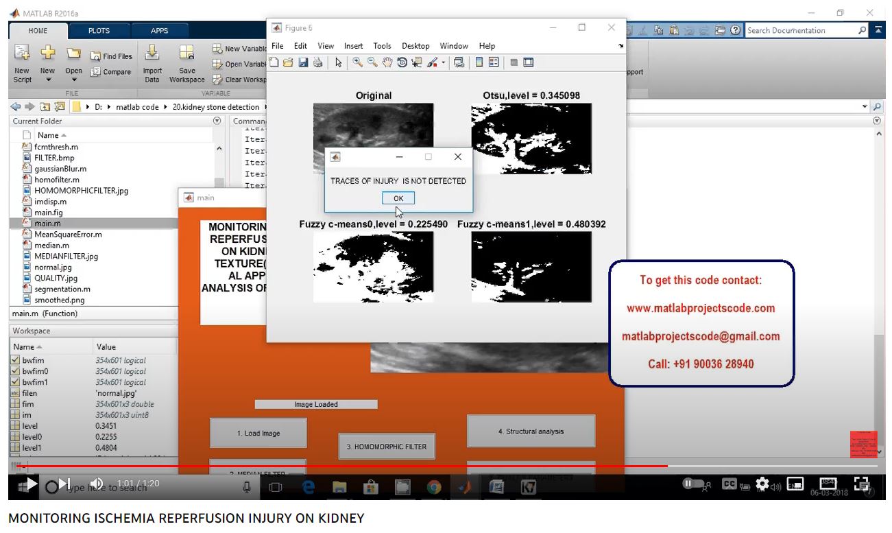 MONITORING ISCHEMIA REPERFUSION INJURY ON KIDNEY project thumbnail image