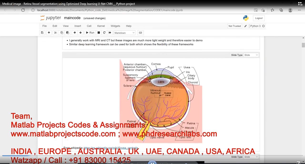 Medical Image - Retina Vessel Segmentation Using Optimized Deep Learning U-Net Cnn __ Python Project project thumbnail image