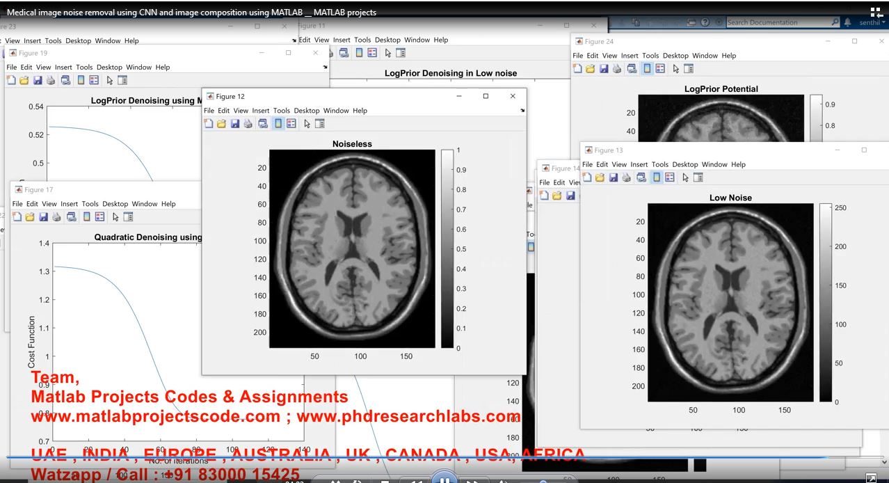 Medical Image Noise Removal Using Cnn And Image Composition Using Matlab __ Matlab Projects project thumbnail image