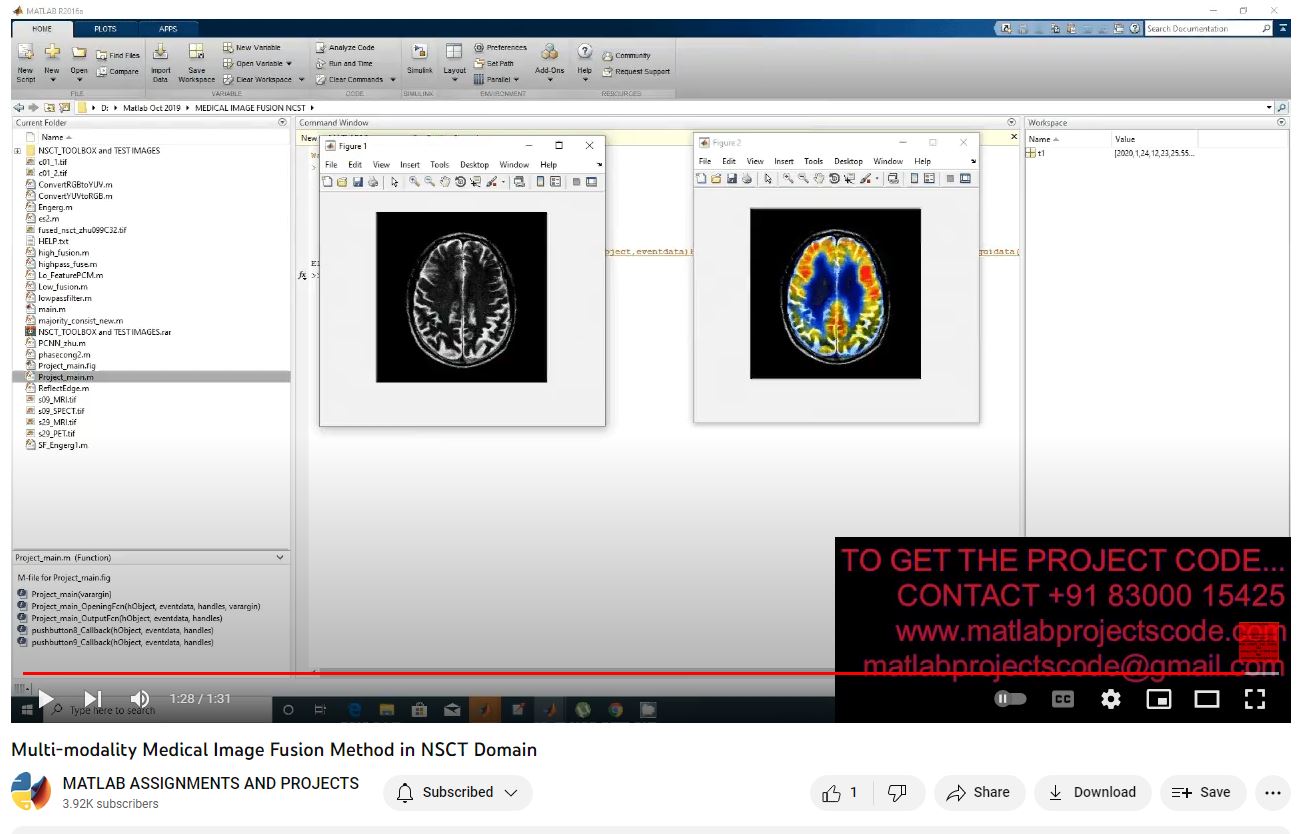 Multi-Modality Medical Image Fusion Method In Nsct Domain project thumbnail image