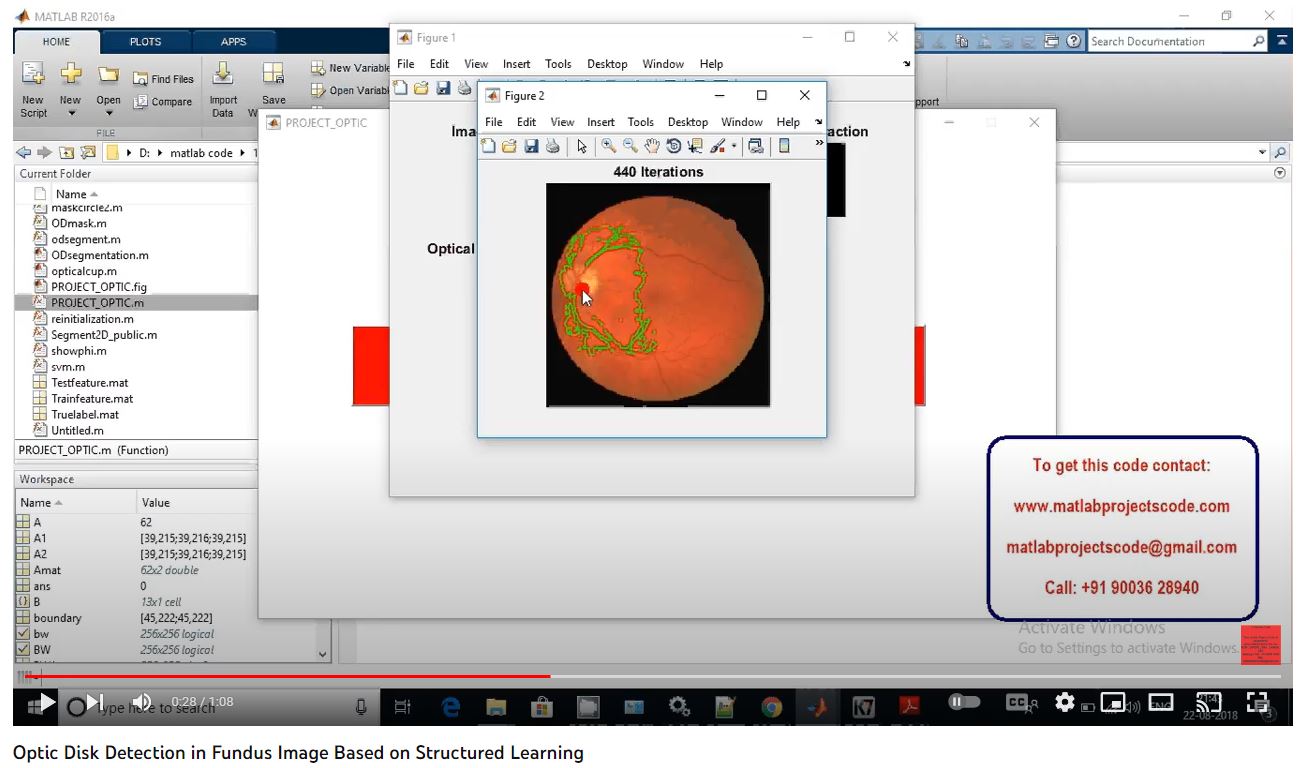 Optic Disk Detection in Fundus Image based on Structured Learning project thumbnail image