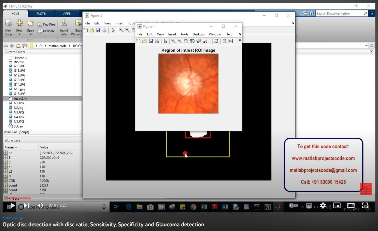 Optic Disc Detection with Disc Ratio, Sensitivity, Specificity and Glaucoma Detection project simulation thumbnail for Signal Processing and AI Engineering