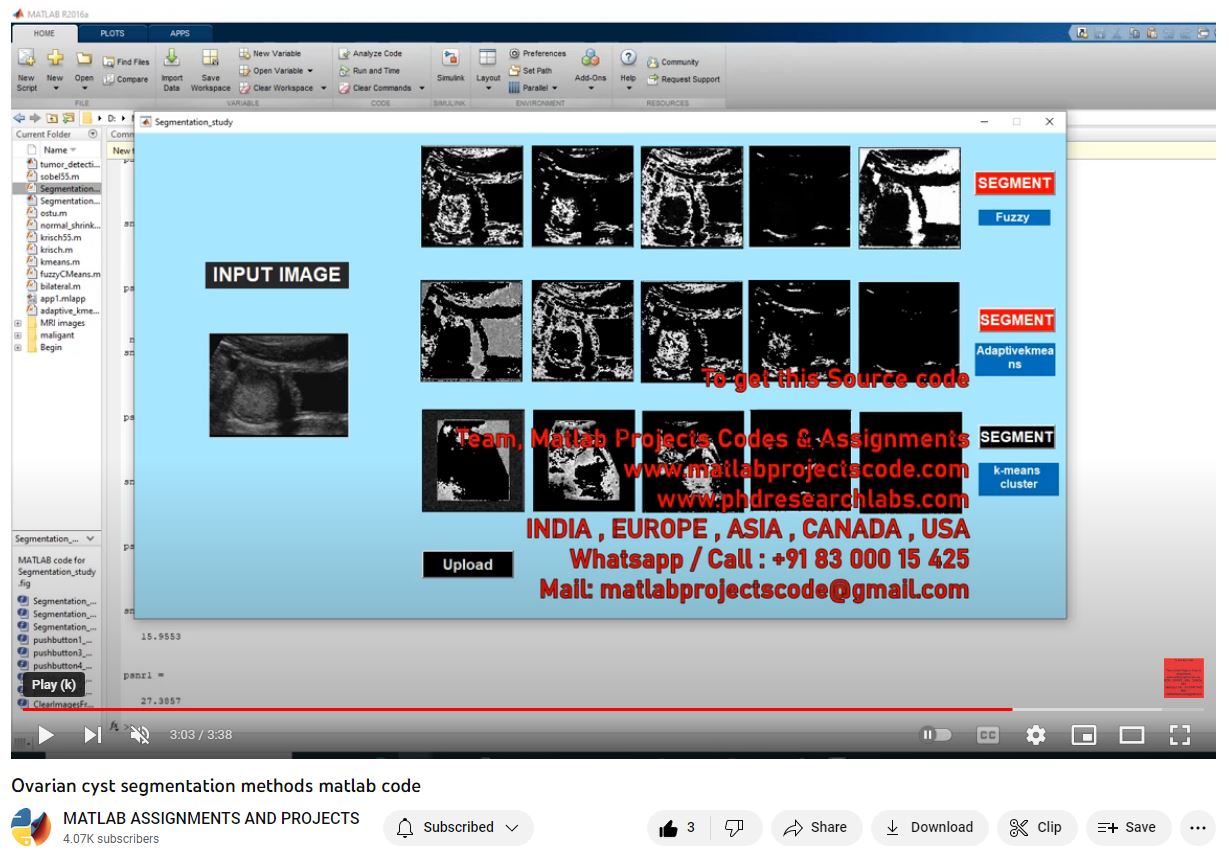 Ovarian Cyst Segmentation Methods Matlab Code-Matlab Simulink-Electrical Assignments-Projects-Phd Research project thumbnail image