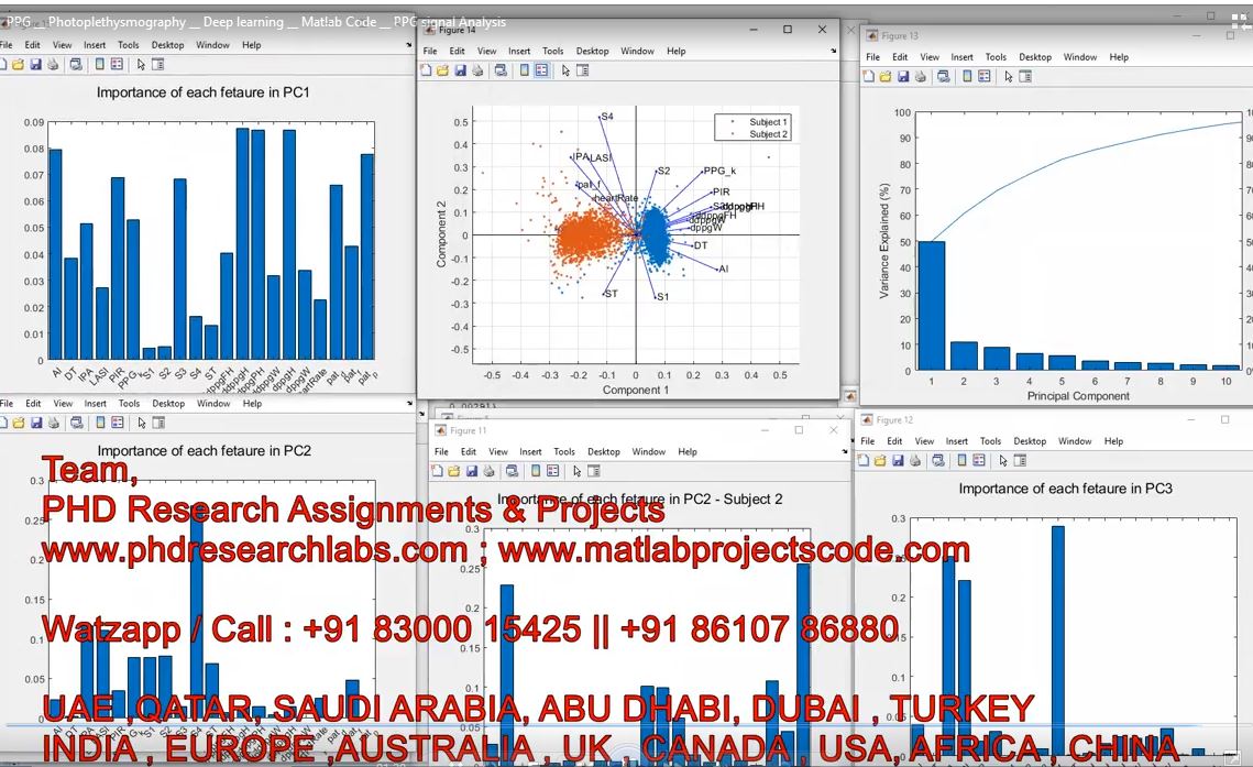 Ppg __ Photoplethysmography __ Deep Learning __ Matlab Code __ Ppg Signal Analysis project thumbnail image