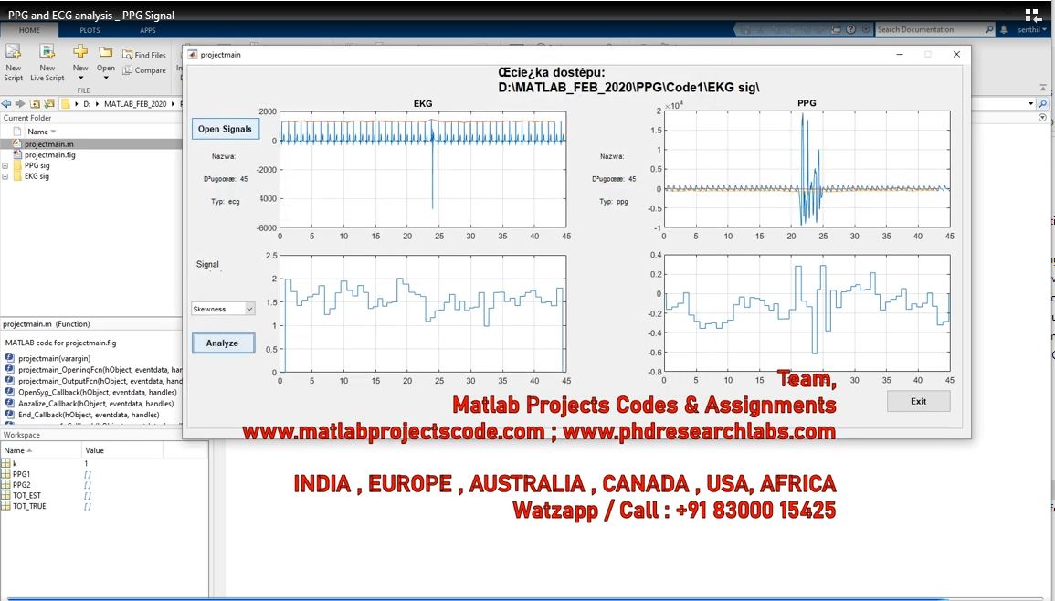 Ppg And Ecg Analysis _ Ppg Signal project thumbnail image
