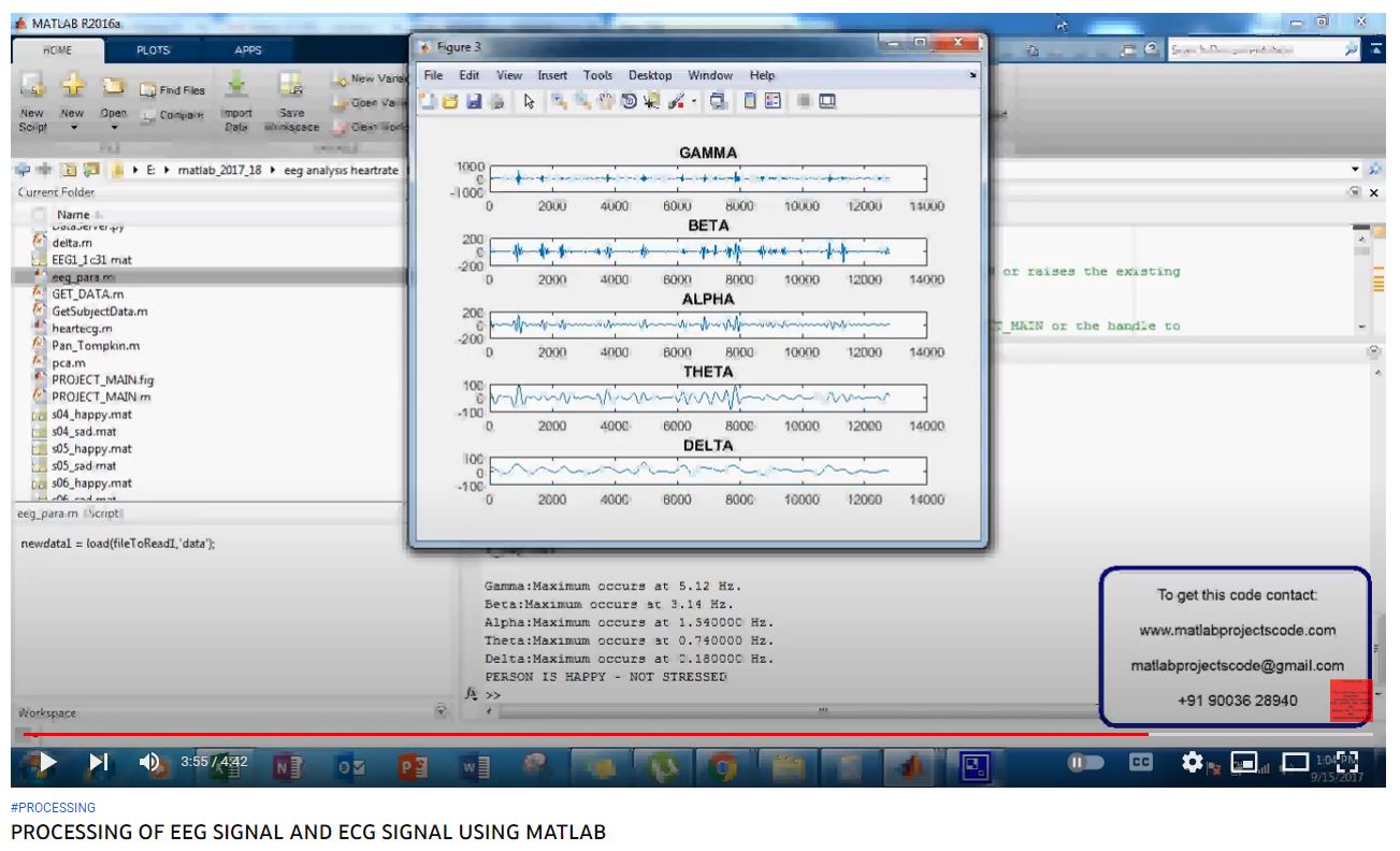 PROCESSING OF EEG SIGNAL AND ECG SIGNAL using MATLAB project thumbnail image