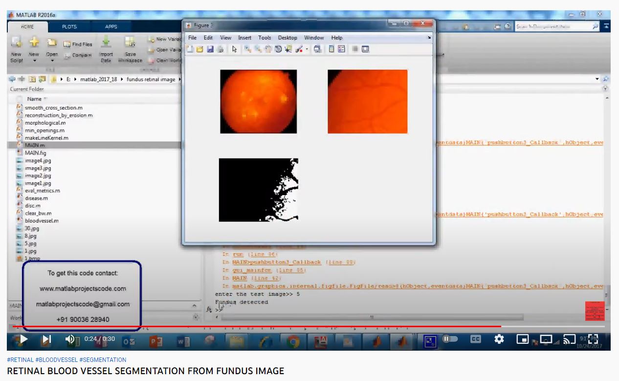 RETINAL BLOOD VESSEL SEGMENTATION FROM FUNDUS IMAGE project thumbnail image