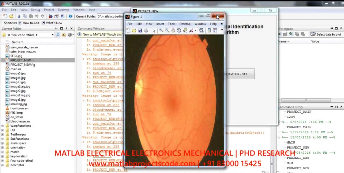 Retinal Identification Based Personal Identification System Using Sift Algorithm project thumbnail image