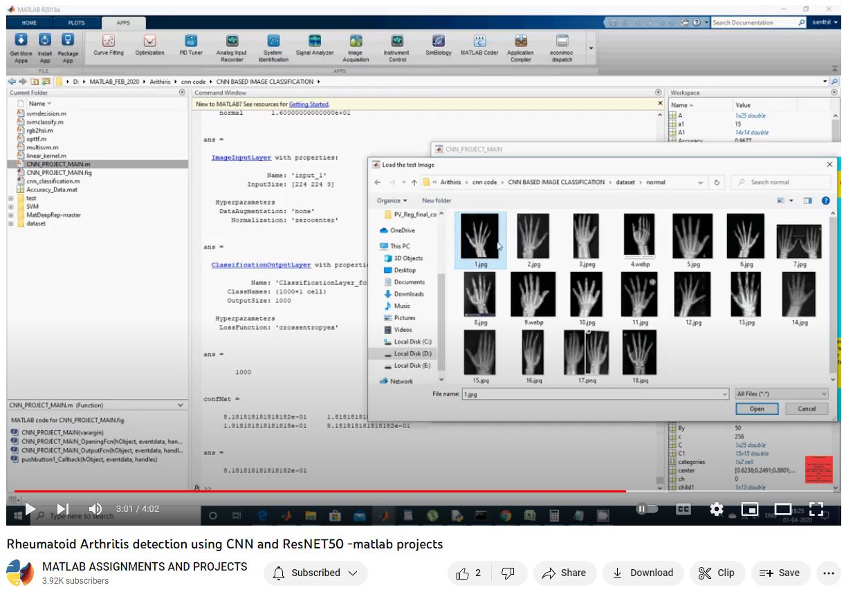 Rheumatoid Arthritis Detection Using Cnn And Resnet50 -Matlab Projects project thumbnail image
