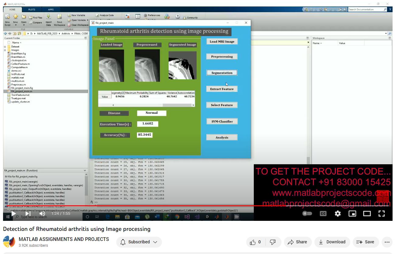 Rheumatoid Arthritis Detection Using Image Processing project thumbnail image