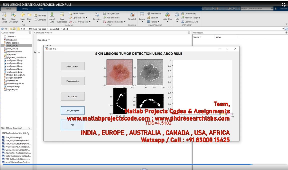Skin Lesions Disease Classification Abcd Rule project thumbnail image