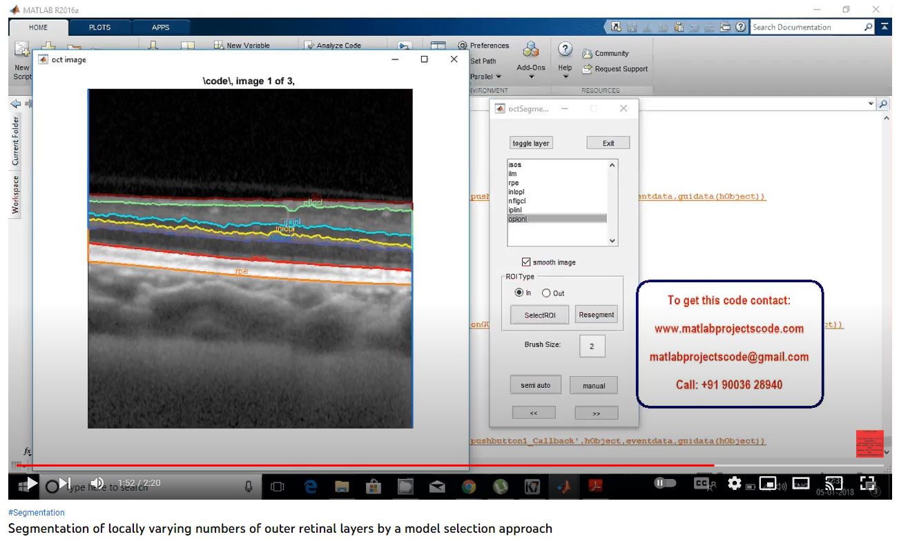 Segmentation of Locally Varying Numbers of Outer Retinal Layers by a Model Selection Approach project thumbnail image