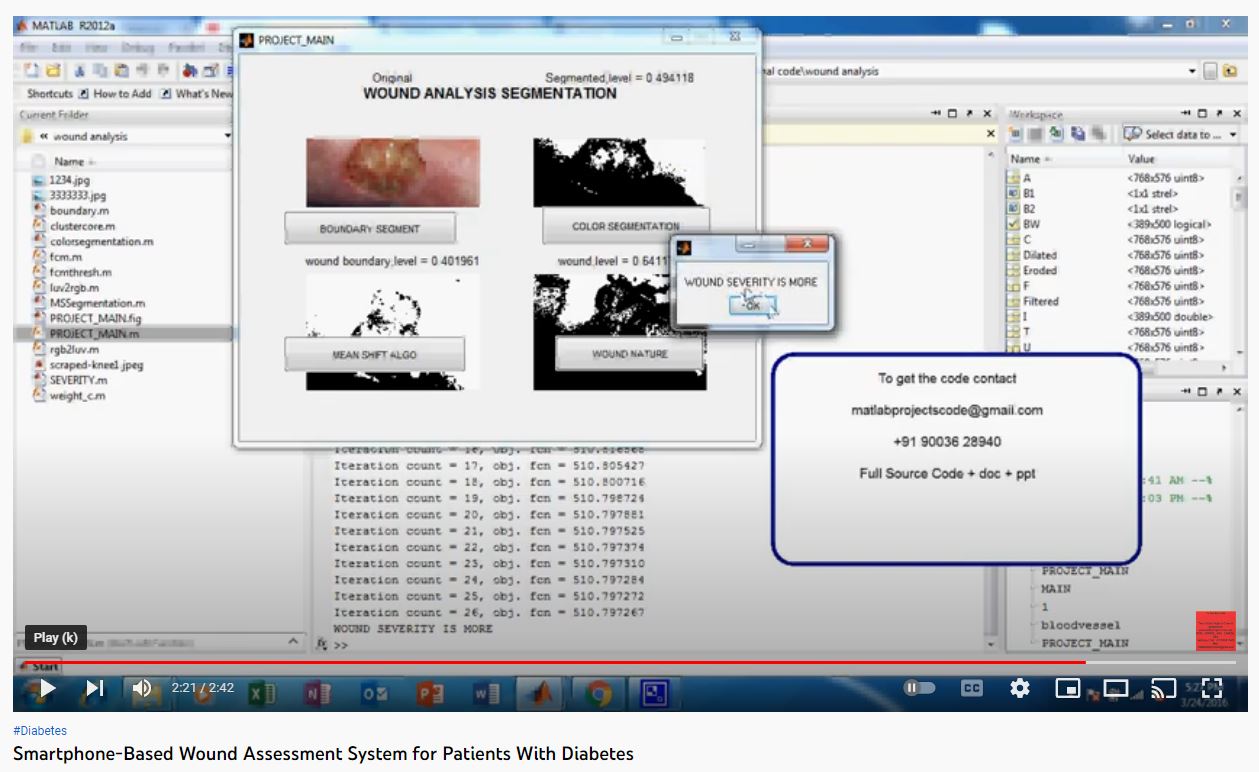 Smartphone-based Wound Assessment System for Patients with Diabetes project thumbnail image