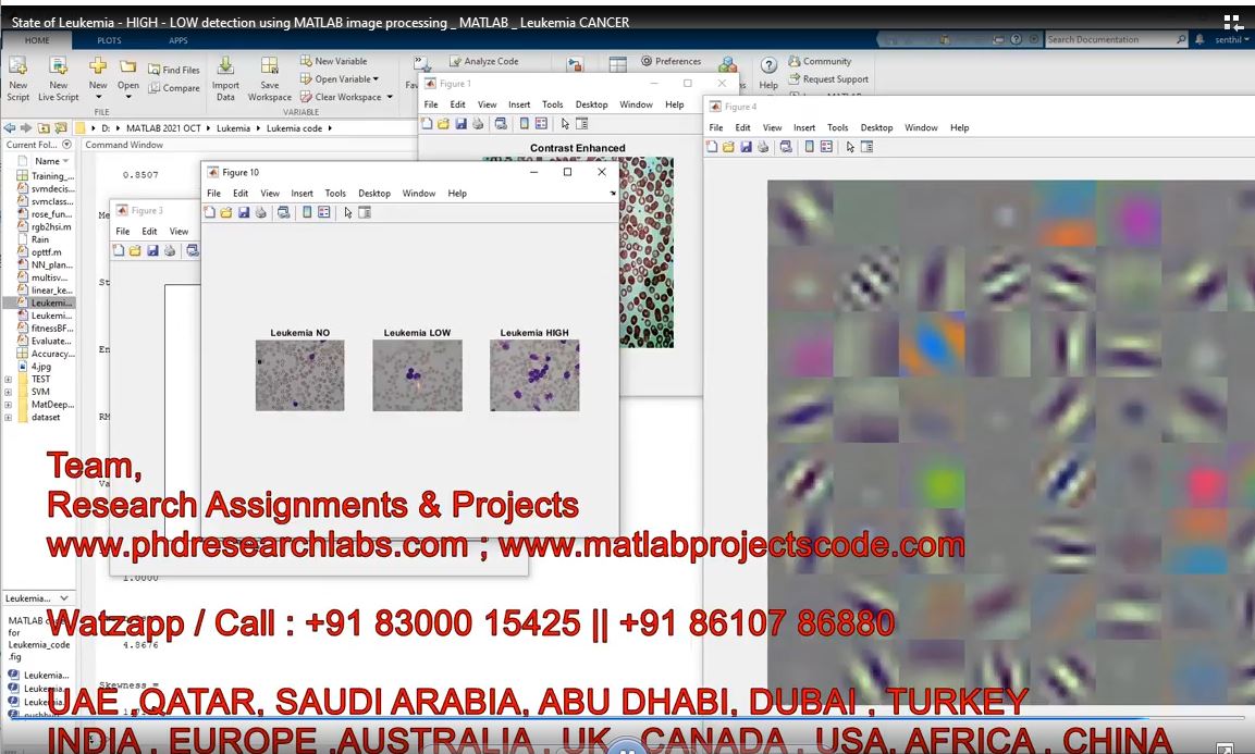 State Of Leukemia - High - Low Detection Using Matlab Image Processing _ Matlab _ Leukemia Cancer project thumbnail image