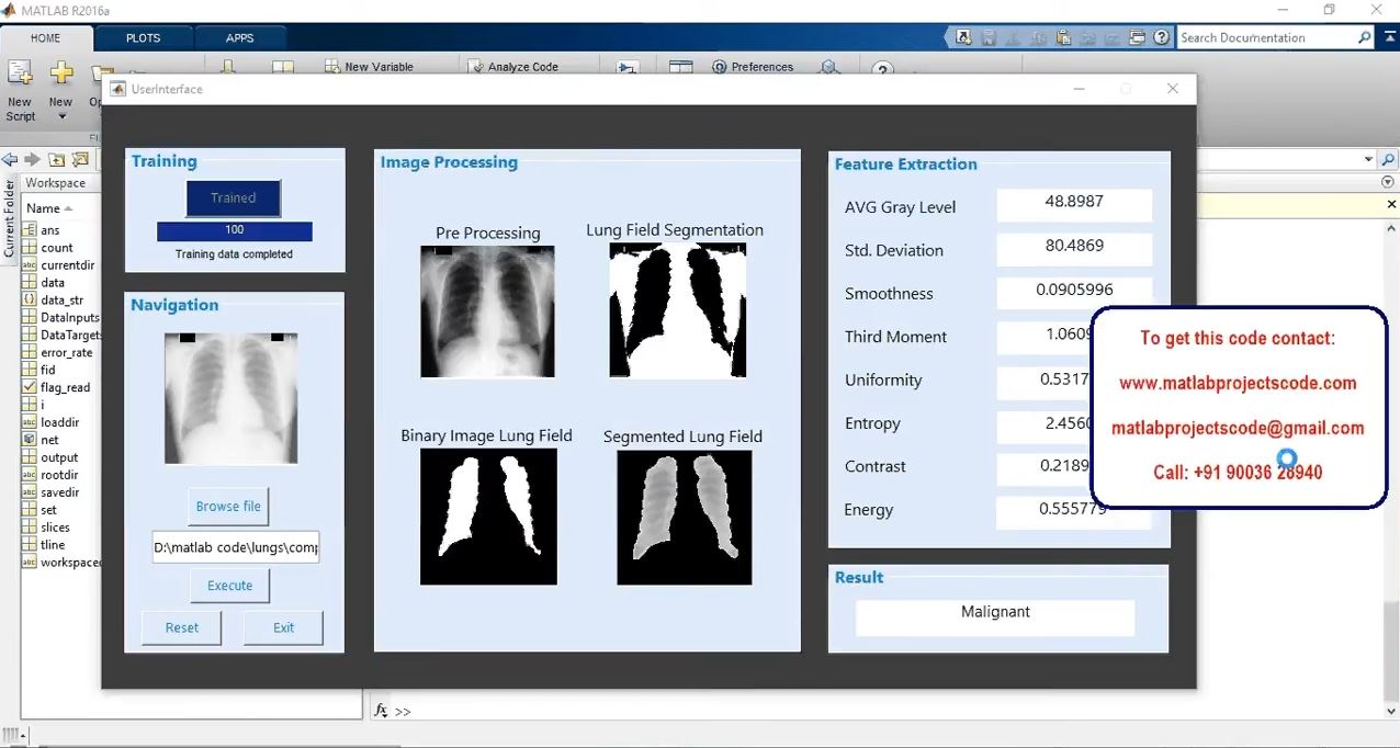 Tuberculosis Detection In Xray Images Using Matlab -Image Processing Project _ Matlab Assignments project thumbnail image