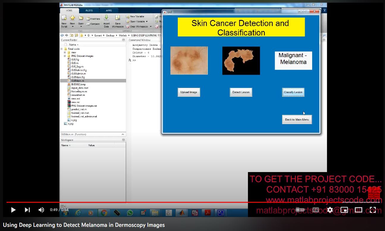 Using Deep Learning To Detect Melanoma In Dermoscopy Images project thumbnail image