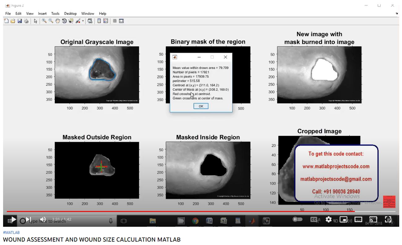 WOUND ASSESSMENT AND WOUND SIZE CALCULATION MATLAB project thumbnail image