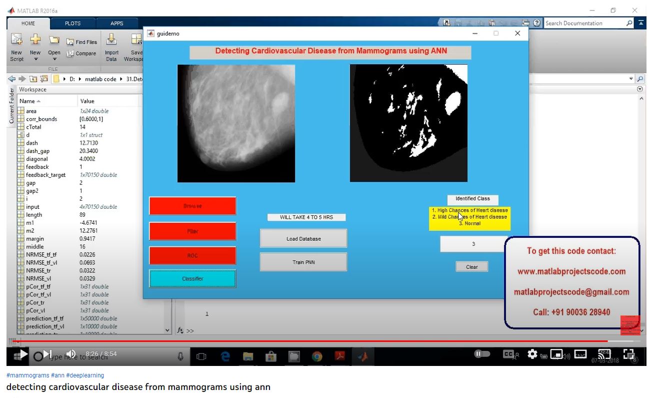 Detecting Cardiovascular Disease from Mammograms using ANN project thumbnail image