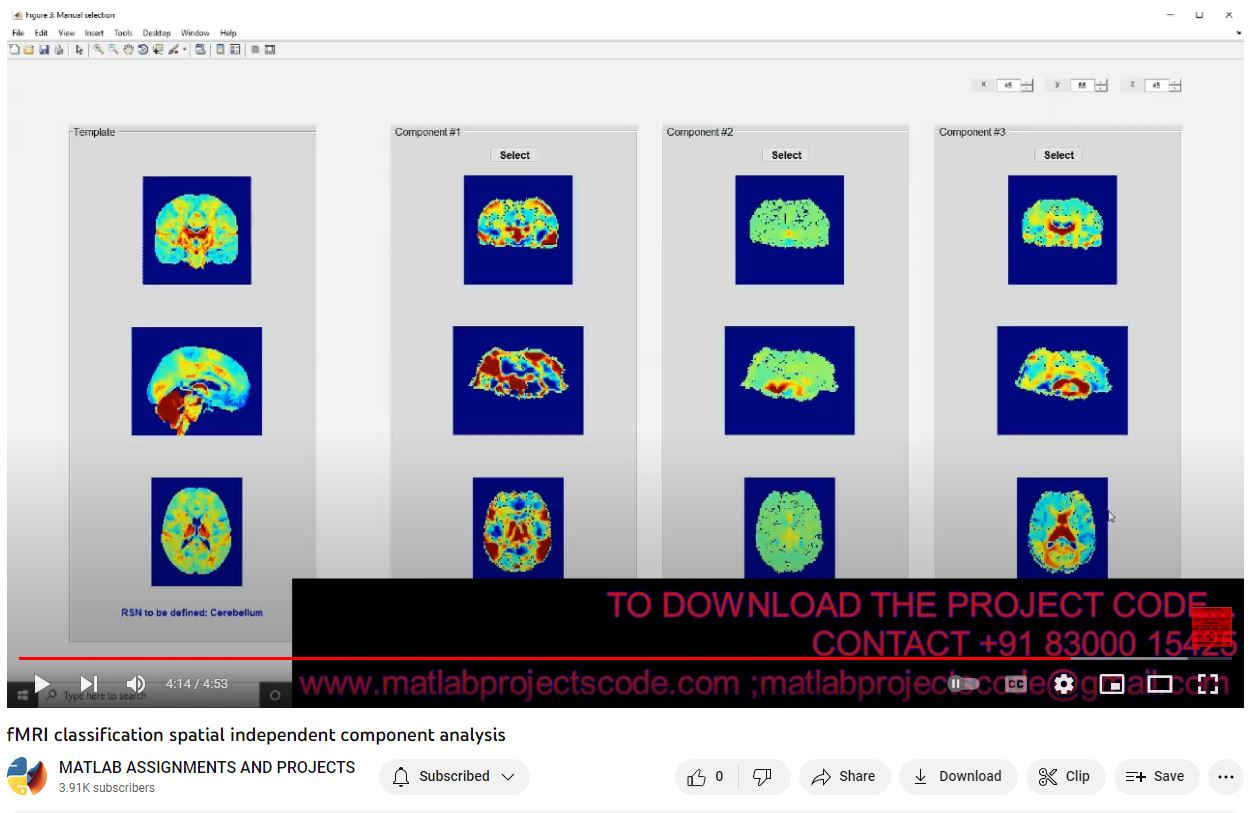 Fmri Classification Spatial Independent Component Analysis project thumbnail image